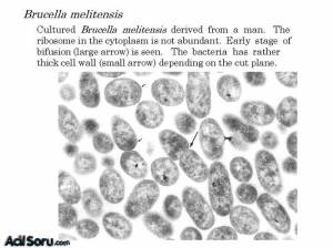 brucella1.jpg